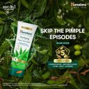 Himalaya Purifying Neem Face Wash | Clears and Prevents Pimples & Acne | 150 ml
