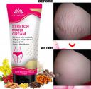 INTIMIFY Pregnancy stretch mark removal cream, Remove Pregnancy Scars For Women 50gm (50 g)...