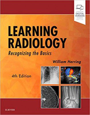Learning Radiology: Recognizing the Basics 