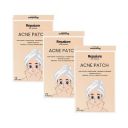 Rejusure Acne Patch | Waterproof Patches | Absorbs Pimple Overnight, Reduces Excess Oil |  Men & Women (Pack of 3)...