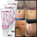 smartdrops SmoothSkin Cream Tube For Women During pregnancy (180 ml)...
